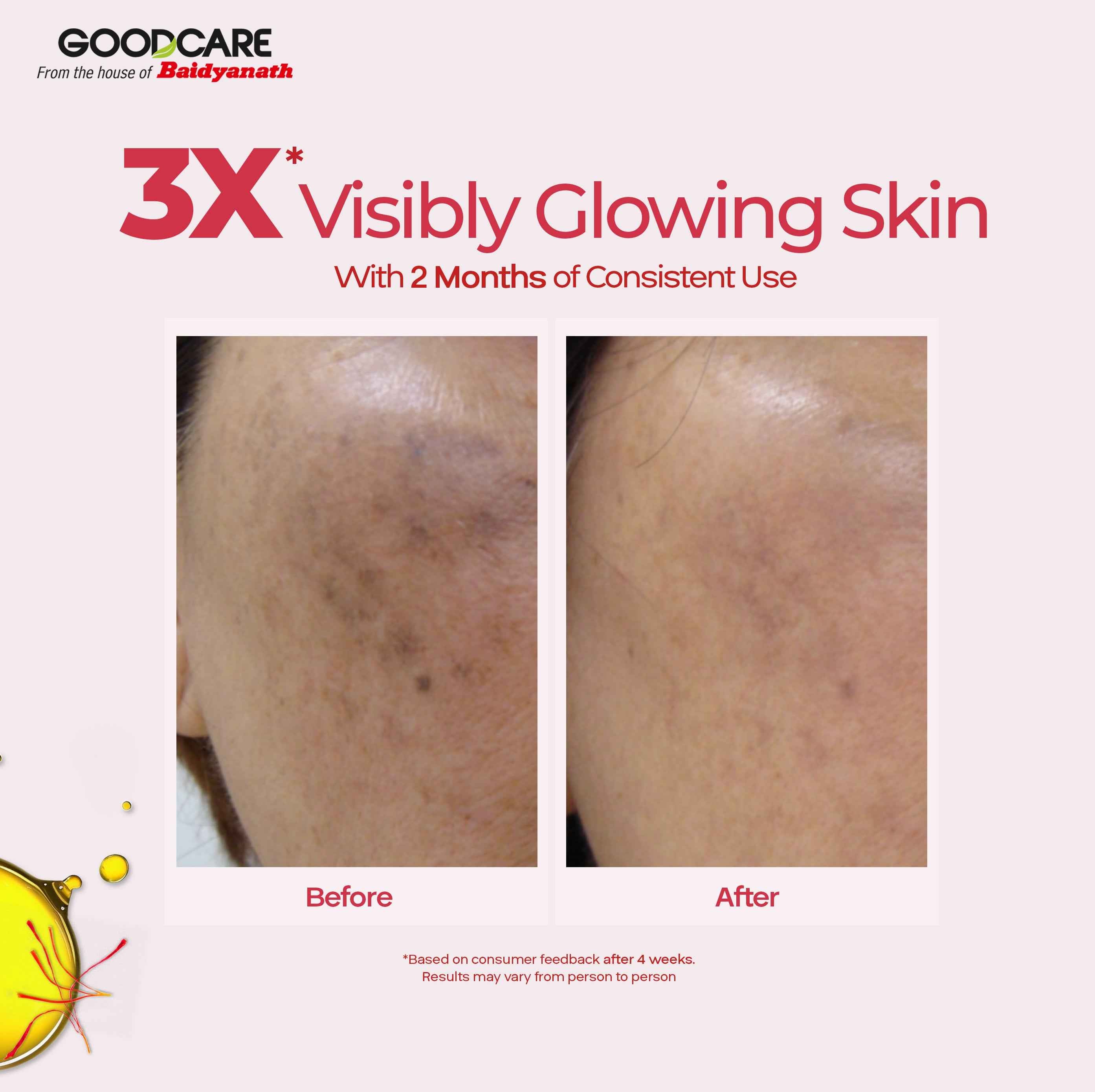 Goodcare Kumkumadi Oil – Ayurvedic Night Serum with Kashmiri Saffron - 30ml