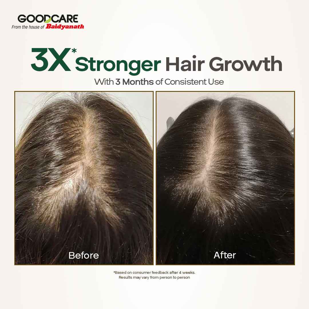 Goodcare Root Boost Hair Oil – With Hibiscus & Bhringraj - 100 ml