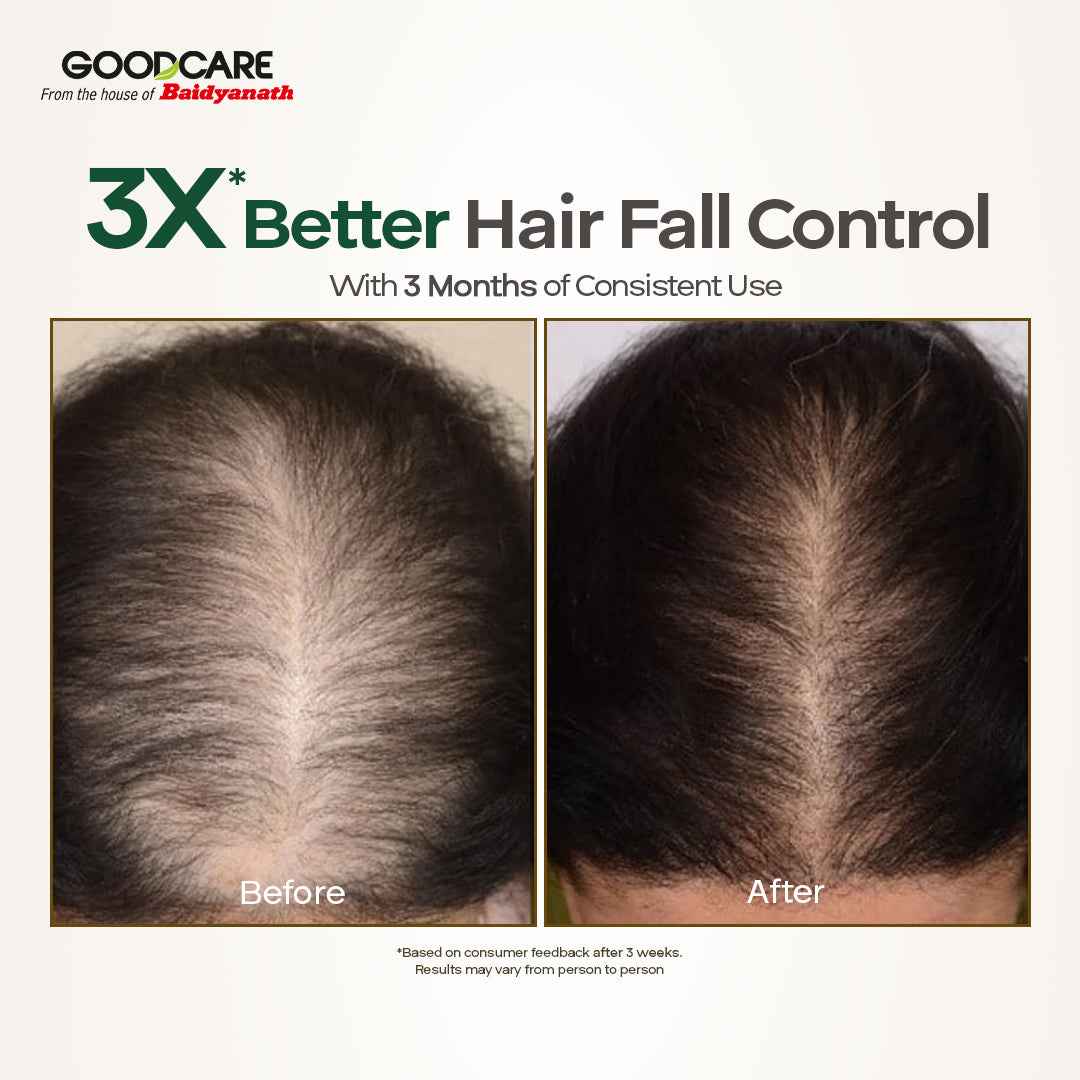Goodcare Root Boost Hair Oil – Enriched with Rosemary & Curry Leaves - 100 ml