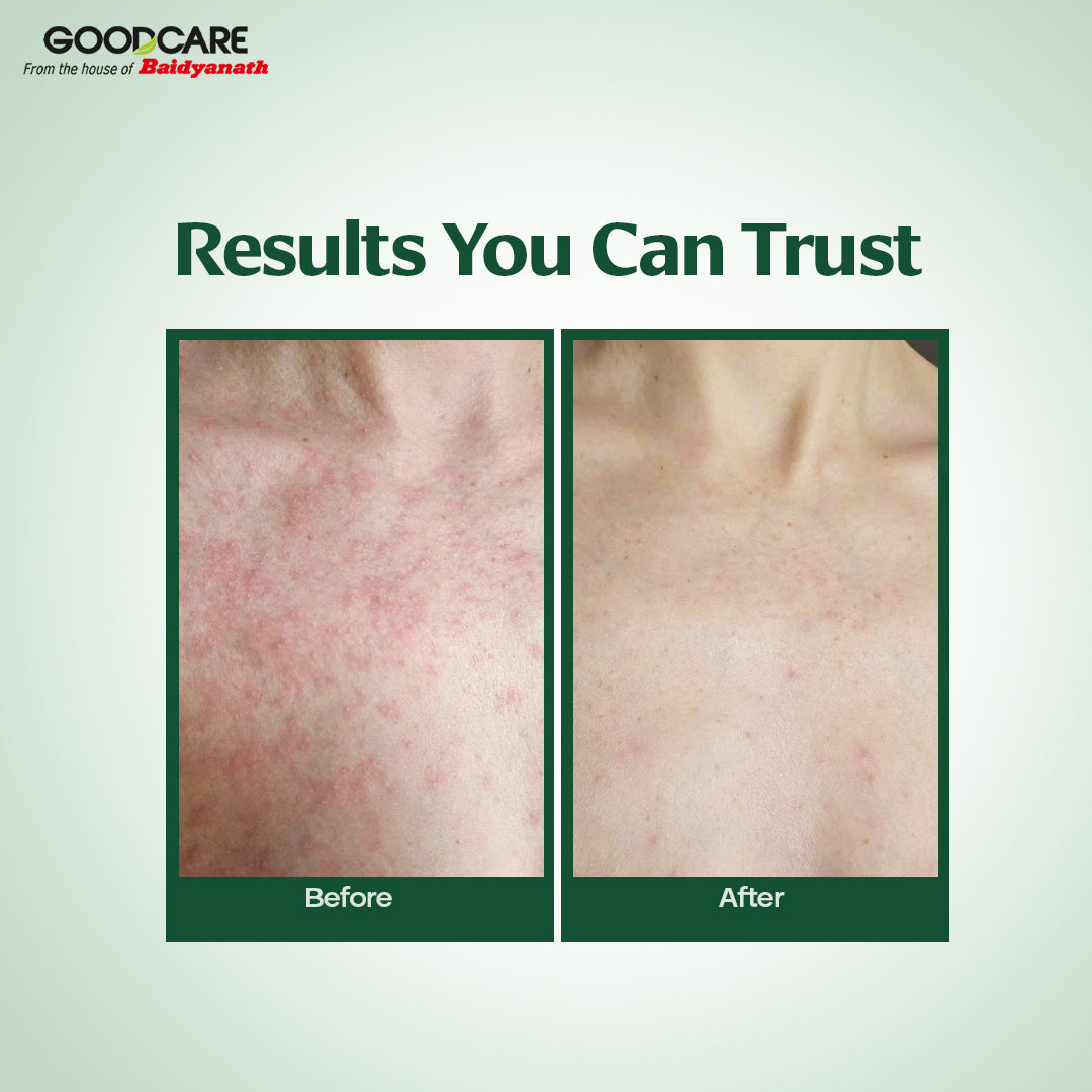 Goodcare Pure Natural Cold Pressed Neem Oil