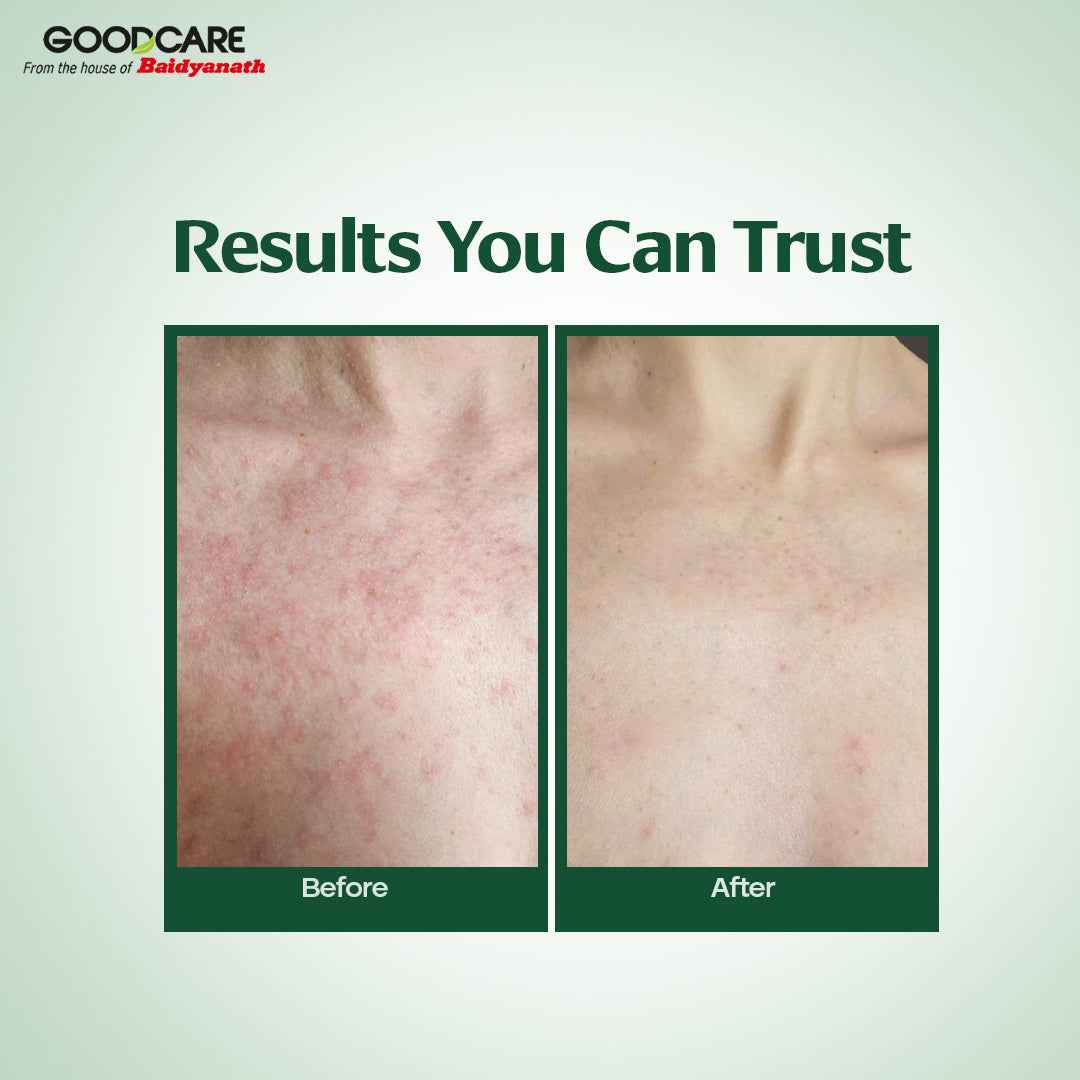 Goodcare Pure Natural Cold Pressed Neem Oil