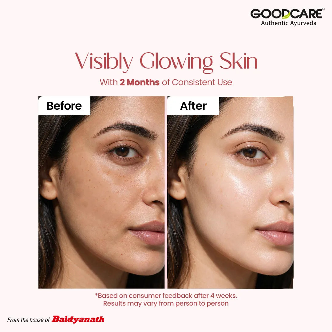 Goodcare Kumkumadi Oil – Ayurvedic Night Serum with Kashmiri Saffron - 30ml