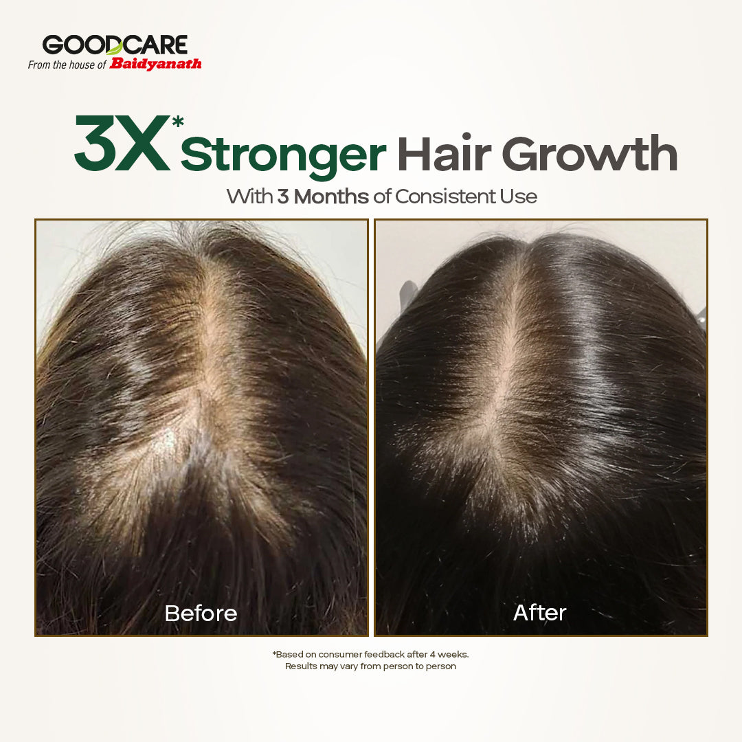 Goodcare Root Boost Hair Oil – With Hibiscus & Bhringraj Strengthens Roots, Nourishes Scalp & Promotes Healthy Hair Growth - 100 ml