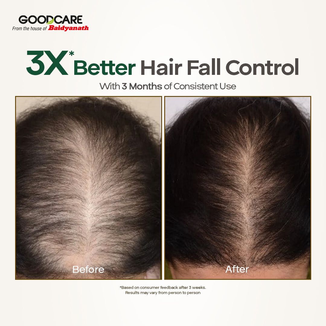 Goodcare Root Boost Hair Oil – Enriched with Rosemary & Curry Leaves, Strengthens Roots, Reduces Hair Fall & Promotes Healthy Growth - 100 ml